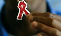 آسیب‌شناسی روانی بیماران مبتلا به HIV