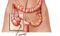 آپاندیس؛ اضافی یا مفید؟