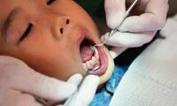 مراقبت‌های بعد از دندانپزشکی