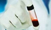 راهنمای تفسیر نتایج آزمایش خون