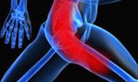 بررسی علل و روش درمان بیماری طولانی ترین عصب بدن