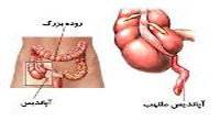 آپاندیس در چه قسمتی از بدن قرار دارد؟