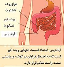 آپاندیس در چه قسمتی از بدن قرار دارد؟