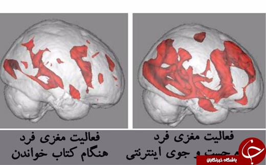 اینترنت چه بلایی سر مغز می‌آورد؟ +عکس