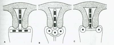 موارد مصرف پرتو درمانی در طب زنان