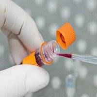 تشخیص سرطان سینوس با آزمایش خون