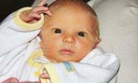 آنچه باید درباره زردی نوزادان بدانید