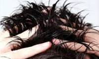 درمان‌های خانگی موی چرب