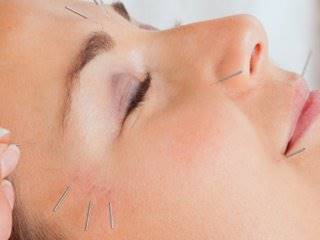 کاربرد طب سوزنی در زیبایی و جوانسازی پوست و مو