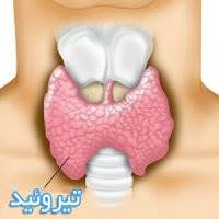 از 6 علت اصلی ابتلا به گواتر، غفلت نکنید!