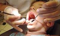 چگونه دندان ها ولثه کودکمان را سالم نگاه داریم؟