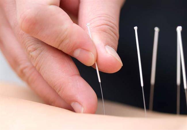 طب سوزنی در کاهش علائم سندروم روده تحریک پذیر نقش مثبتی داشته است.