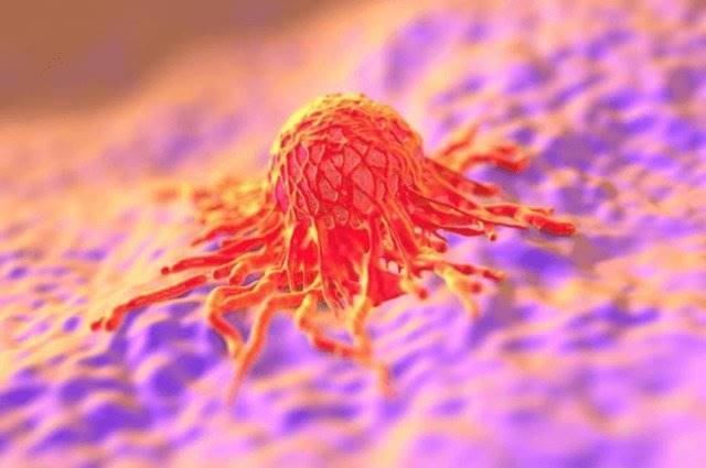 تزریق محلول اتانول برای مقابله با تومورهای سرطانی