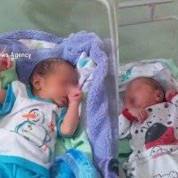 رهاسازی نوزادان دوقلو در بیمارستان
