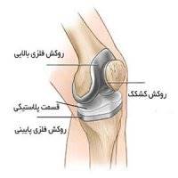 اقدامات درمانی بعد از تعویض مفصل زانو/چگونه سرعت بهبودی بعد از عمل را افزایش دهیم؟