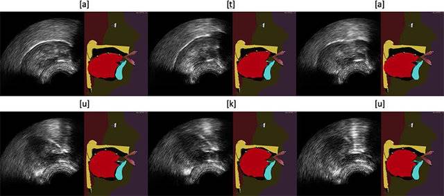 مشاهده نحوه حرکت زبان با تکنیک جدید سونوگرافی