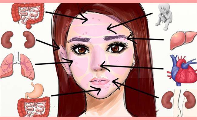face-mapping-what-is-your-acne-t