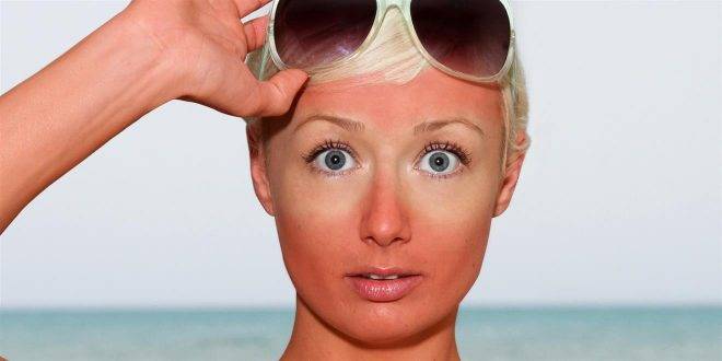 آفتاب سوختگی و 7 راه برای بهبود پوست