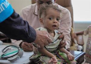 ارسال نهصد هزار واکسن بیماری‌های کشنده به صنعا