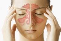 سردرد سینوسی؛ دلایل، علائم و درمان