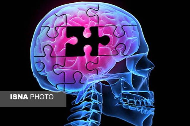6 فاکتور موثر در پیشرفت آلزایمر