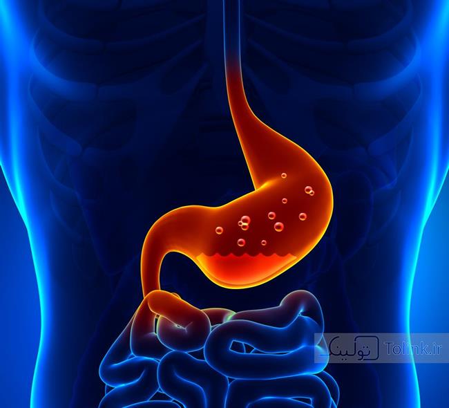 غذاهایی که سوزش سر معده را تحریک می‌کنند