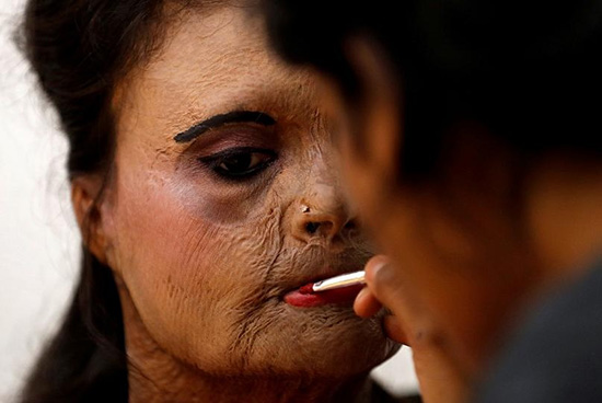 فشن شو قربانیان اسید پاشی در هندوستان (فوری)