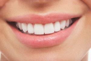 چگونه دندان های سفید داشته باشیم