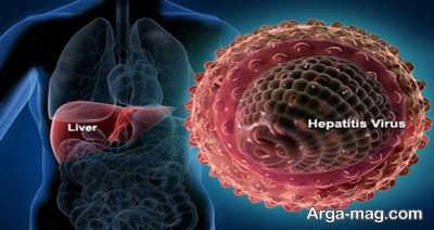 راه های درمان هپاتیت ب در خانه 