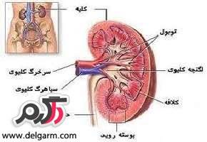 نشانه های درست کار نکردن کلیه چیست؟