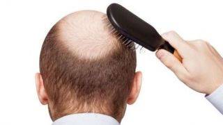 روزی چندتار مو از سرتان کم شود؟