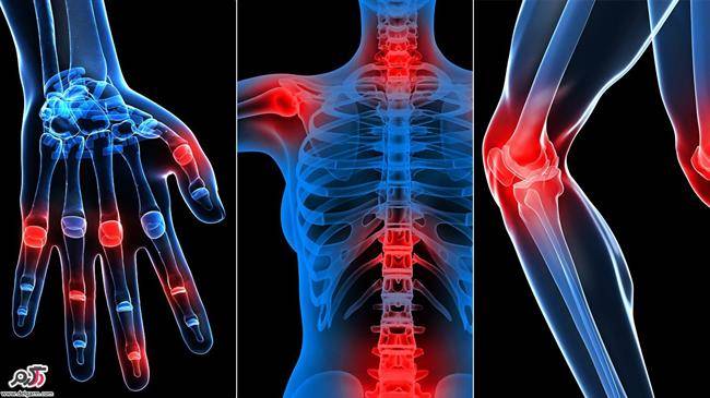 Photo rheumatic disease