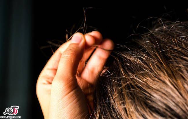 تریکوتیلومانیا یا اختلال کندن موی وسواسی
