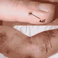 تب کریمه کنگو سالانه چند قربانی میگیرد؟