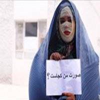 مرگ تدریجی قربانیان اسیدپاشی؛ مجازات اسیدپاشی همچنان در هالهای از ابهام