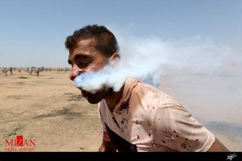شلیک مستقیم گاز اشک آور صهیونیست‌ها به صورت جوان فلسطینی + تصاویر