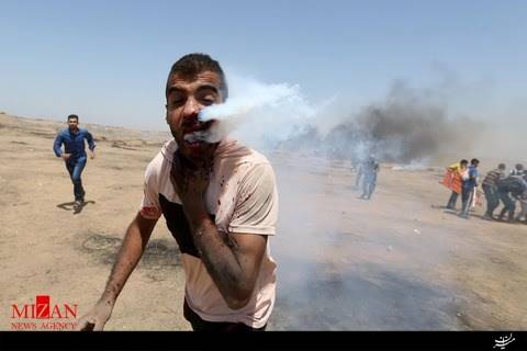 شلیک مستقیم گاز اشک آور صهیونیست‌ها به صورت جوان فلسطینی + تصاویر