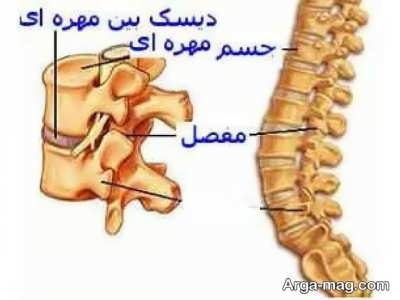 درمان قطعی دیسک کمر با داروهای گیاهی