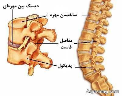 راه های درمان قطعی دیسک کمر