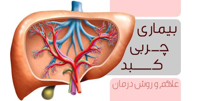 علایم بیماری چربی کبد و راههای درمان