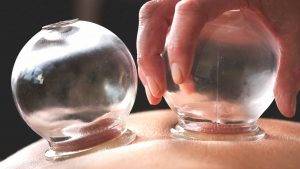 cupping حجامت بادکش