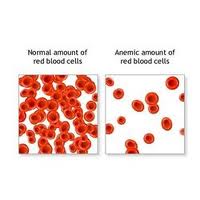 بیماری هایی که با علایم کم خونی بروز می کند