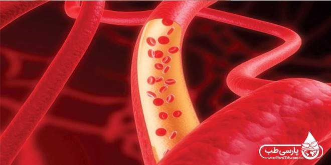 غلظت خون: آنچه در ارتباط با غلظت خون باید بدانید
