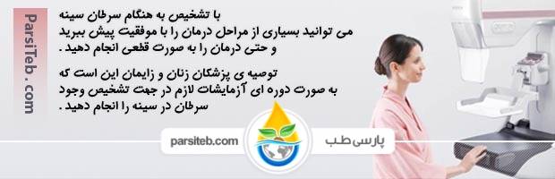 اهمیت ماموگرافی