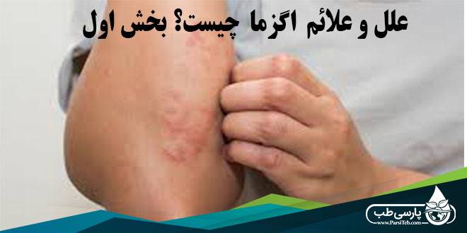 اگزما: علل و علائم  بروز اگزما در بدن چیست؟ (بخش اول)