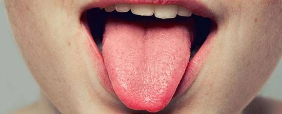 نشانه های سرطان روی زبان!