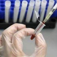 چرا در آزمایش‌های پیش از ازدواج، HIV و هپاتیت لحاظ نمی‌شود؟