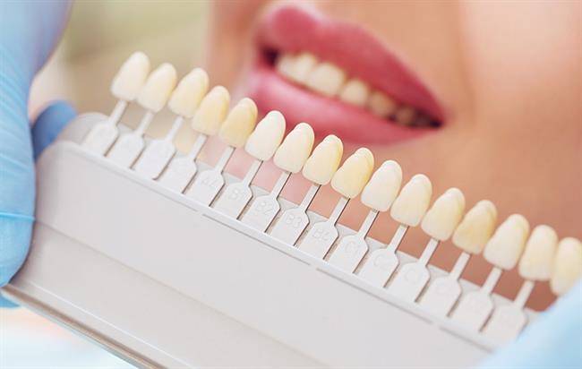 علت زردی دندان چیست؟