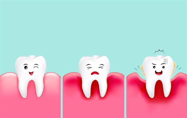 از بیماری لثه چقدر می‌دانید؟