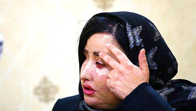 پرونده اسید پاشی اصفهان به کجا ختم می‌شود؟